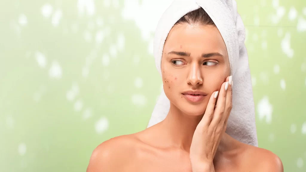 Facial Mapping for Acne: Understanding Breakouts Through Chinese Medicine