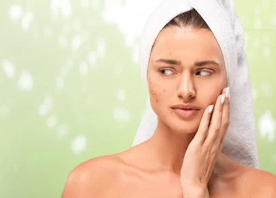 Facial Mapping for Acne: Understanding Breakouts Through Chinese Medicine