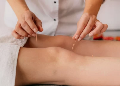 Acupuncture in Vancouver: Supporting Pain Relief and Mental Health